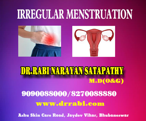 Best irregular menstruation treatment clinic in bhubaneswar near me
